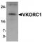 Vitamin K Epoxide Reductase Complex Subunit 1 antibody, TA320006, Origene, Western Blot image 