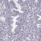 Sperm surface protein Sp17 antibody, HPA037568, Atlas Antibodies, Immunohistochemistry paraffin image 