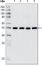 Histone Deacetylase 3 antibody, abx010931, Abbexa, Enzyme Linked Immunosorbent Assay image 