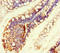 Regulator Of Telomere Elongation Helicase 1 antibody, LS-C679372, Lifespan Biosciences, Immunohistochemistry paraffin image 