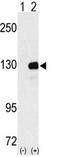 UPF1 RNA Helicase And ATPase antibody, AP11687PU-N, Origene, Western Blot image 