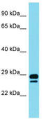Deleted in azoospermia-like antibody, TA345772, Origene, Western Blot image 