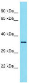YOD1 Deubiquitinase antibody, TA331556, Origene, Western Blot image 