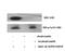 Discoidin Domain Receptor Tyrosine Kinase 1 antibody, P00905, Boster Biological Technology, Western Blot image 