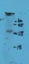 Natural Cytotoxicity Triggering Receptor 2 antibody, orb13334, Biorbyt, Western Blot image 