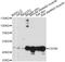 Corneodesmosin antibody, A04329, Boster Biological Technology, Western Blot image 