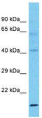 Forkhead Box Q1 antibody, TA334251, Origene, Western Blot image 