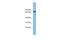 Lamin B Receptor antibody, ARP45263_P050, Aviva Systems Biology, Western Blot image 