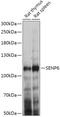 Sentrin-specific protease 6 antibody, 18-038, ProSci, Western Blot image 