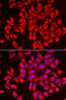DDB1- and CUL4-associated factor 7 antibody, 14-967, ProSci, Immunofluorescence image 
