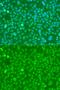 Ubiquitin C antibody, GTX33569, GeneTex, Immunocytochemistry image 