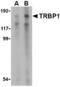 TAR (HIV-1) RNA Binding Protein 1 antibody, TA306379, Origene, Western Blot image 