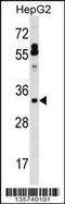Pulmonary surfactant-associated protein B antibody, 58-400, ProSci, Western Blot image 