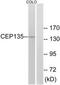 Centrosomal Protein 135 antibody, TA311705, Origene, Western Blot image 