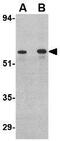 Plexin domain-containing protein 2 antibody, GTX85419, GeneTex, Western Blot image 