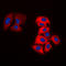 Tyrosine Hydroxylase antibody, LS-C354110, Lifespan Biosciences, Immunofluorescence image 