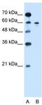 Tyrosinase antibody, TA335226, Origene, Western Blot image 