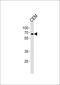 Zinc Finger Protein 90 antibody, PA5-35171, Invitrogen Antibodies, Western Blot image 