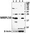 Mitochondrial Ribosomal Protein L50 antibody, A17223-1, Boster Biological Technology, Western Blot image 