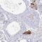 5'-Nucleotidase, Cytosolic IIIB antibody, HPA057095, Atlas Antibodies, Immunohistochemistry frozen image 