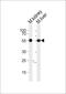 Casein Kinase 1 Gamma 3 antibody, PA5-71858, Invitrogen Antibodies, Western Blot image 