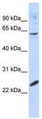 Dpc4 antibody, TA343528, Origene, Western Blot image 