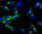 Protein Kinase CAMP-Dependent Type II Regulatory Subunit Beta antibody, NBP2-67061, Novus Biologicals, Immunofluorescence image 