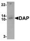 Death Associated Protein antibody, A02756-1, Boster Biological Technology, Western Blot image 