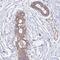 POTE Ankyrin Domain Family Member F antibody, PA5-60301, Invitrogen Antibodies, Immunohistochemistry paraffin image 