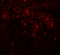 Protein Inhibitor Of Activated STAT 1 antibody, 5741, ProSci, Immunofluorescence image 