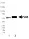Polo Like Kinase 5 antibody, TA336863, Origene, Western Blot image 