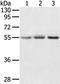CWC27 Spliceosome Associated Cyclophilin antibody, PA5-50750, Invitrogen Antibodies, Western Blot image 