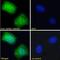 Abhydrolase Domain Containing 5 antibody, NB100-57850, Novus Biologicals, Immunocytochemistry image 