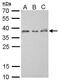 ZW10 Interacting Kinetochore Protein antibody, GTX628915, GeneTex, Western Blot image 