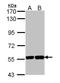 Karyopherin Subunit Alpha 2 antibody, NBP1-33508, Novus Biologicals, Western Blot image 