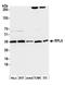 Ribosomal Protein L5 antibody, A303-933A, Bethyl Labs, Western Blot image 