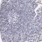 Histone H1.0 antibody, HPA000843, Atlas Antibodies, Immunohistochemistry paraffin image 