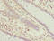 Tumor Suppressor 2, Mitochondrial Calcium Regulator antibody, orb39547, Biorbyt, Immunohistochemistry paraffin image 