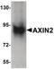 Axin 2 antibody, PA5-21093, Invitrogen Antibodies, Western Blot image 