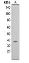 CD79b Molecule antibody, LS-C354594, Lifespan Biosciences, Western Blot image 