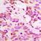 Cytosolic beta-glucosidase antibody, orb256555, Biorbyt, Immunohistochemistry paraffin image 