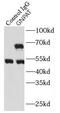 Glyceronephosphate O-Acyltransferase antibody, FNab03551, FineTest, Immunoprecipitation image 