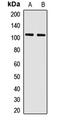 Protocadherin Alpha 13 antibody, LS-C668893, Lifespan Biosciences, Western Blot image 