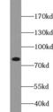 Bruton Tyrosine Kinase antibody, FNab09846, FineTest, Western Blot image 