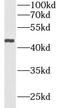 Acid Phosphatase, Prostate antibody, FNab00085, FineTest, Western Blot image 