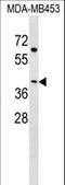 N-Terminal EF-Hand Calcium Binding Protein 2 antibody, LS-C158375, Lifespan Biosciences, Western Blot image 