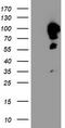 Cast antibody, TA504351, Origene, Western Blot image 