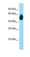 Gastric Inhibitory Polypeptide Receptor antibody, orb331253, Biorbyt, Western Blot image 