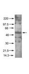 Protein kinase B antibody, TA319275, Origene, Western Blot image 