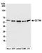 Dynactin Subunit 4 antibody, A304-986A, Bethyl Labs, Western Blot image 